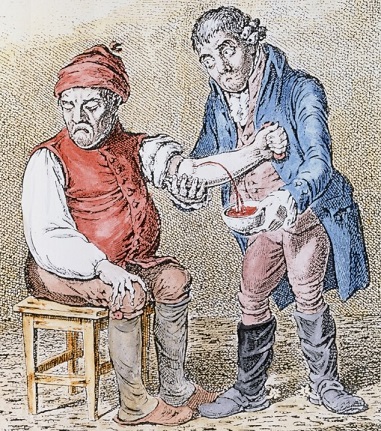 medieval doctor bleeding a patient
