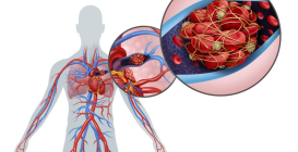 Vaccine Blood Clots