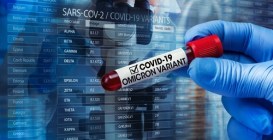 Researcher,With,Blood,Sample,Of,New,Variant,Of,The,Covid-19