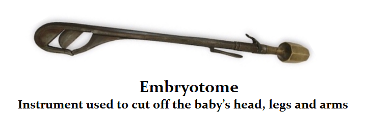 Embryotome abortion