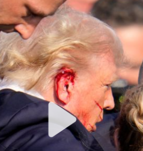 Trump ear