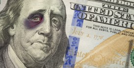 Bruised,,Battered,And,Black,Eyed,Ben,Franklin,On,The,Newly